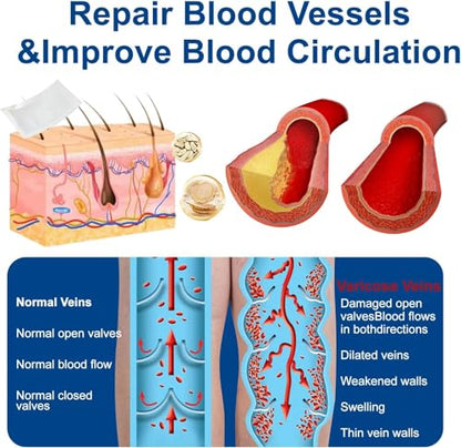 Vein Ease Microdarts Varicose Veins Treatment Patch | Amavheaf
